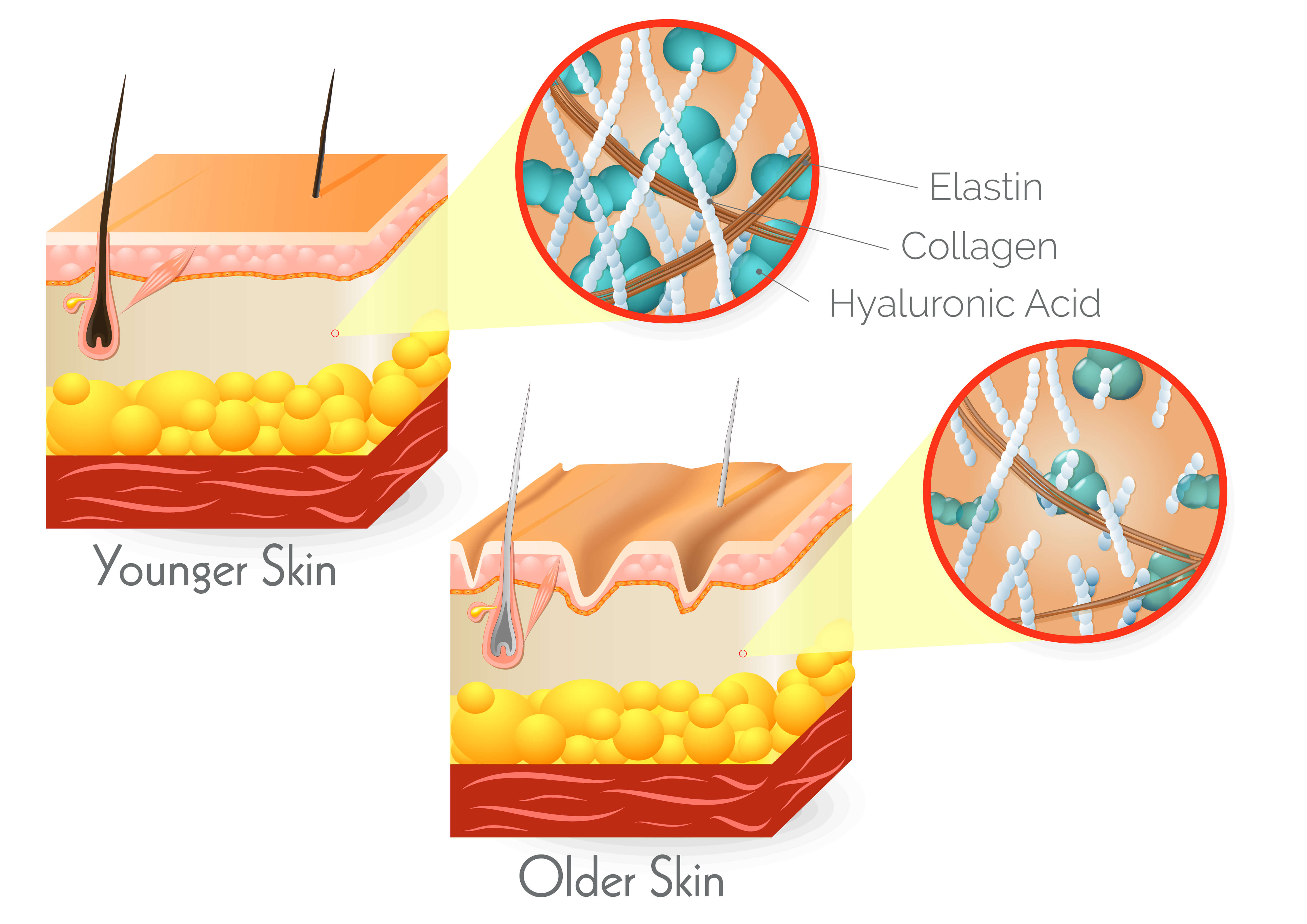 Infographic on younger versus older skin 