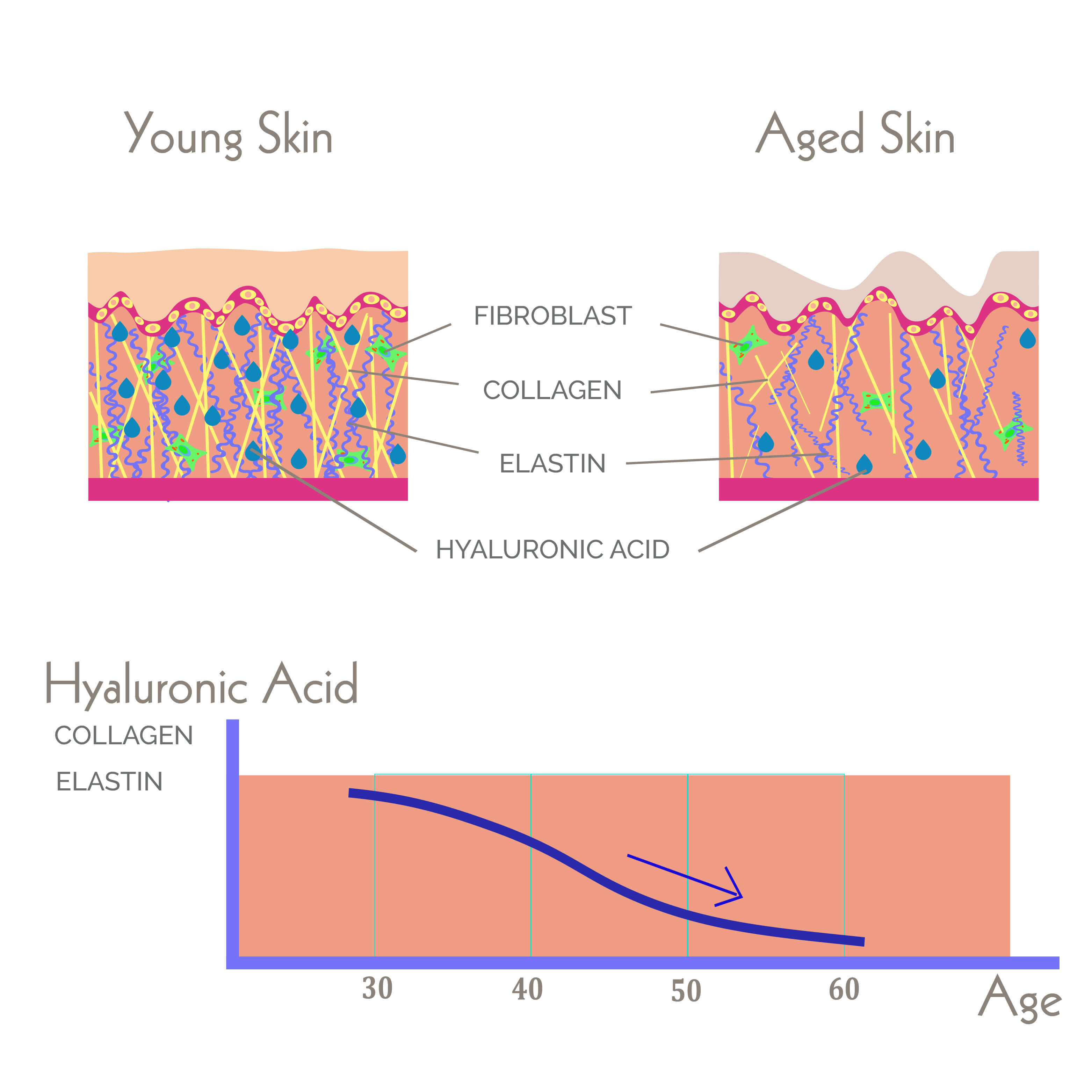 Illustration of young versus aged skin, with hyaluronic acid, collagen and elastin content