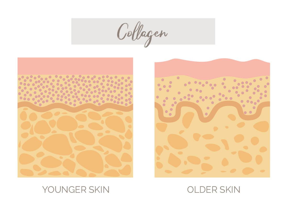 Infographic on collagen in the skin 