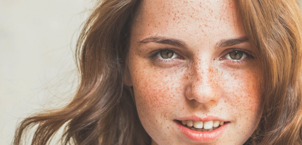 Woman with freckles on her face.